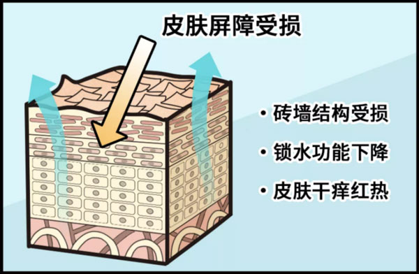 皮膚屏障受損后應該如何修護？